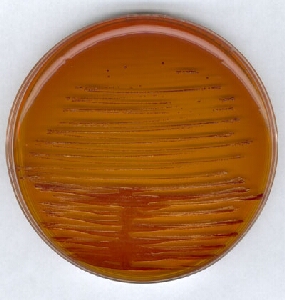 KF sterptococcai agar base